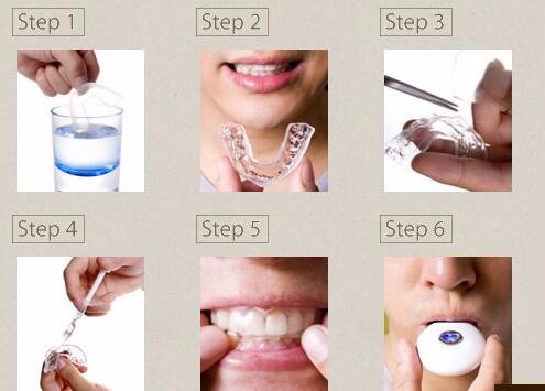 Moldable Invisible Braces Teeth Whitening Tool